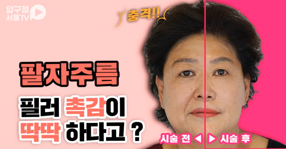 50대 여사님의 팔자주름 리얼 시술 후기! 관련 이미지 1