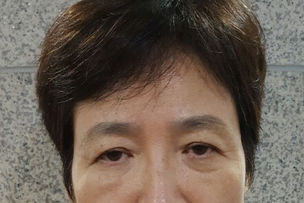 A Dramatic Transformation for Brighter, Clearer Eyes: A 5-Year Follow-Up Review of Forehead Lift Surgery in Your 60s image 1