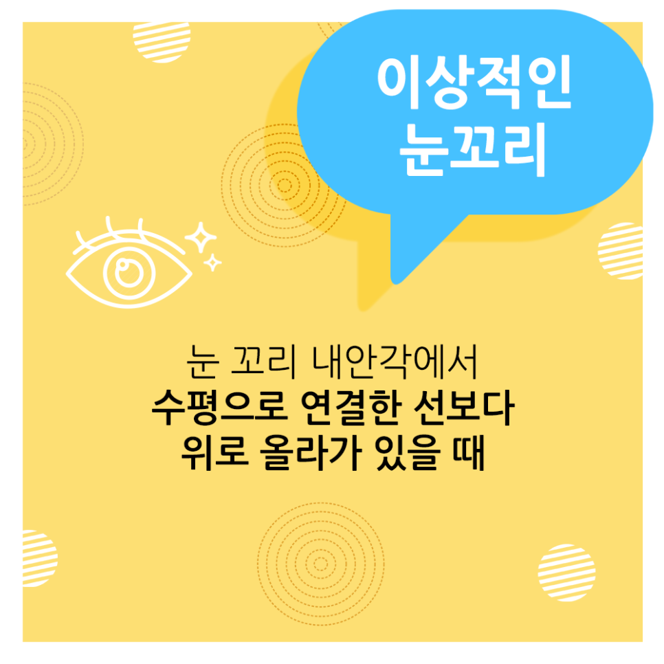 What Is the Ideal Eye Shape, According to Apgujeong Seoul Plastic Surgery? image 4