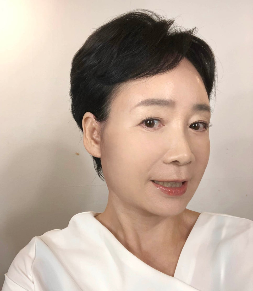 [다시, 청춘 프로젝트]60대 안면거상, 목거상 3개월 경과 후기 관련 이미지 3