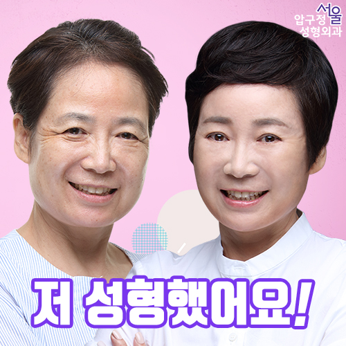 10년전으로 돌아간 60대 엄마의 성형 고백! 관련 이미지 8