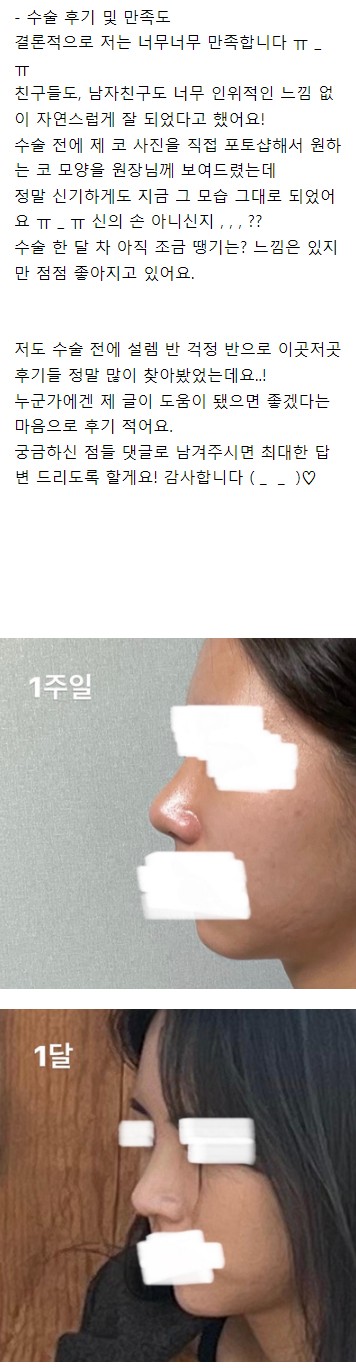 Escape from a Low Nasal Bridge at Apgujeong Seoul Plastic Surgery! image 7
