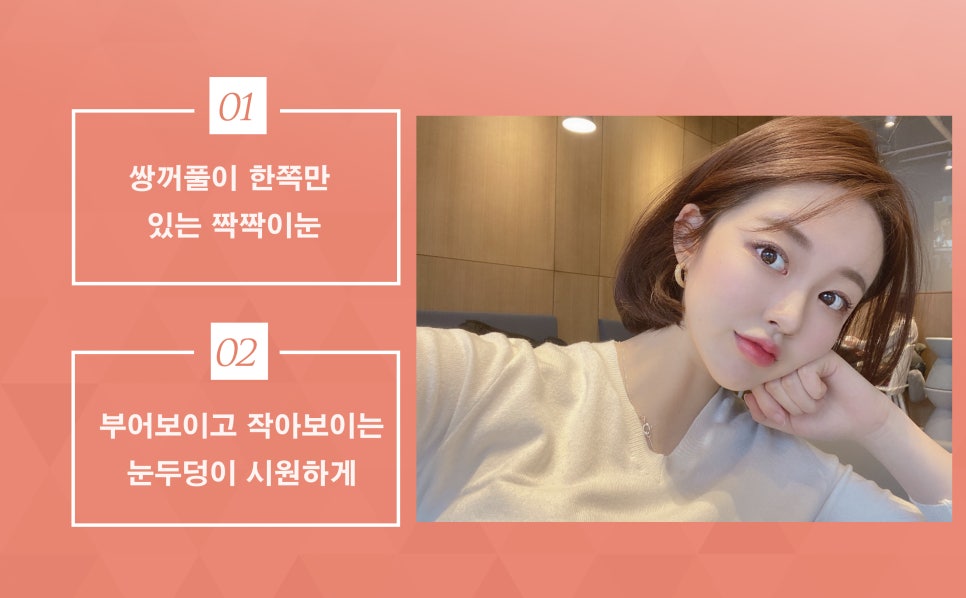 Eyelid correction @ Apgujeong Seoul Plastic Surgery, a great place for eyelid correction! image 2