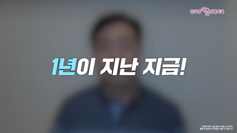 남자 이마거상 1년 후 실제 후기와 수술 전 알아야 할 핵심 포인트 관련 이미지 6