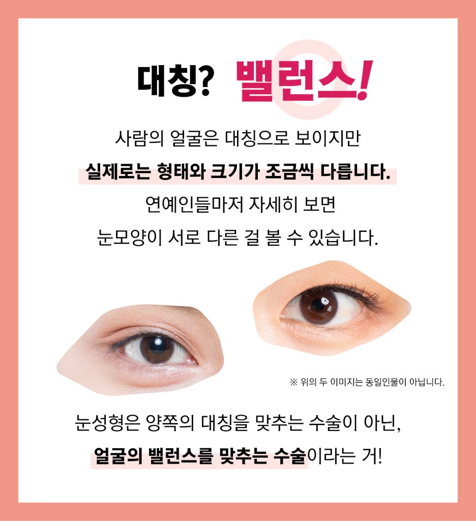Asymmetrical Face at Apgujeong Seoul Plastic Surgery image 3