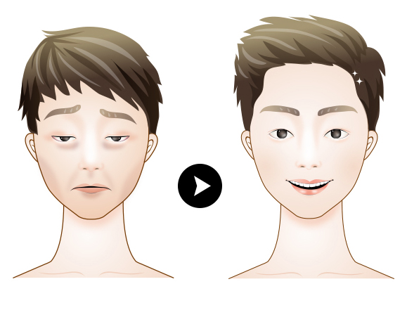 눈매교정과 쌍수 똑같은 줄 아셨나요? 관련 이미지 1