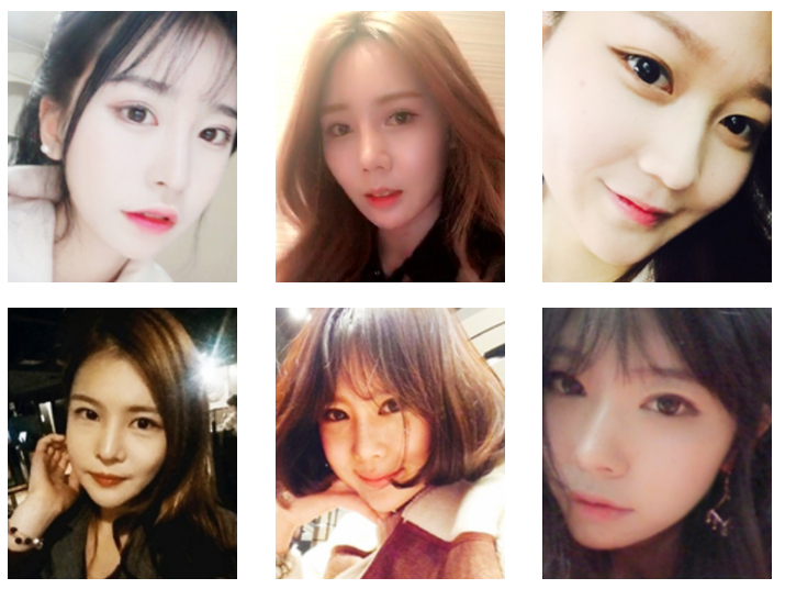 압구정서울성형외과 눈/코 성형 후기가 궁금하다면? 관련 이미지 3
