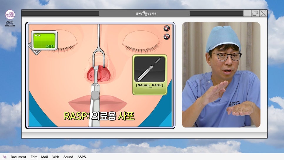 매부리코 코수술 게임 후기 및 비중격연골 매부리 코수술 방법 코수술 진행 과정 압구정서울성형외과 관련 이미지 15
