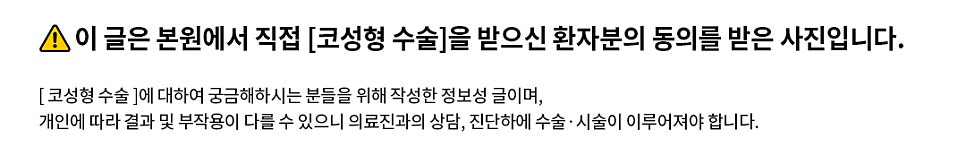 IU’s Small Nose and Low Nasal Bridge Surgery at Apgujeong Seoul Plastic Surgery image 4