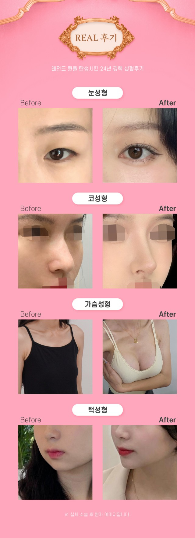 압구정서울성형외과 2025년 수험생을 위한 수능이벤트 오픈! 관련 이미지 6