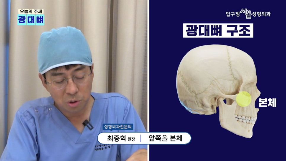 Types of Zygoma Reduction Surgery, Contour Surgery That Can Correct a Peanut-Shaped Face | Apgujeong Seoul Plastic Surgery image 2