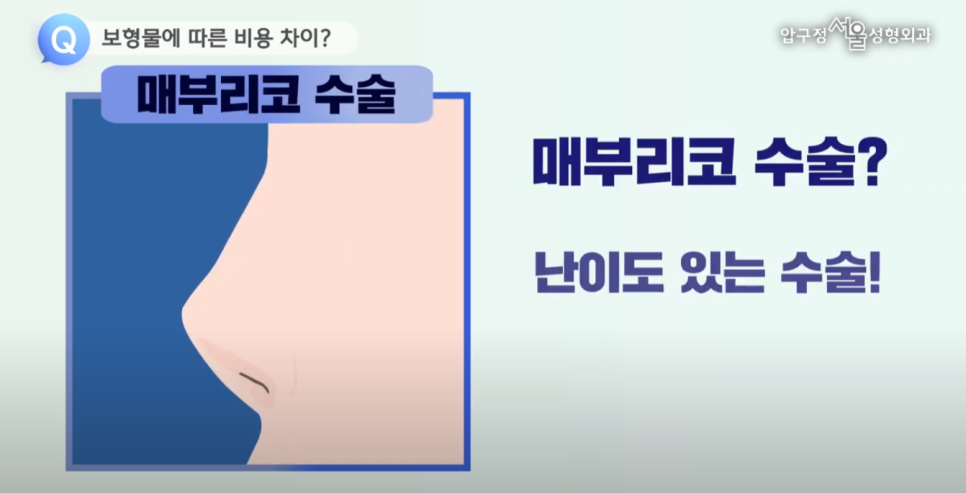 쌍커풀수술 비용이 병원 마다 다른 이유? 관련 이미지 7