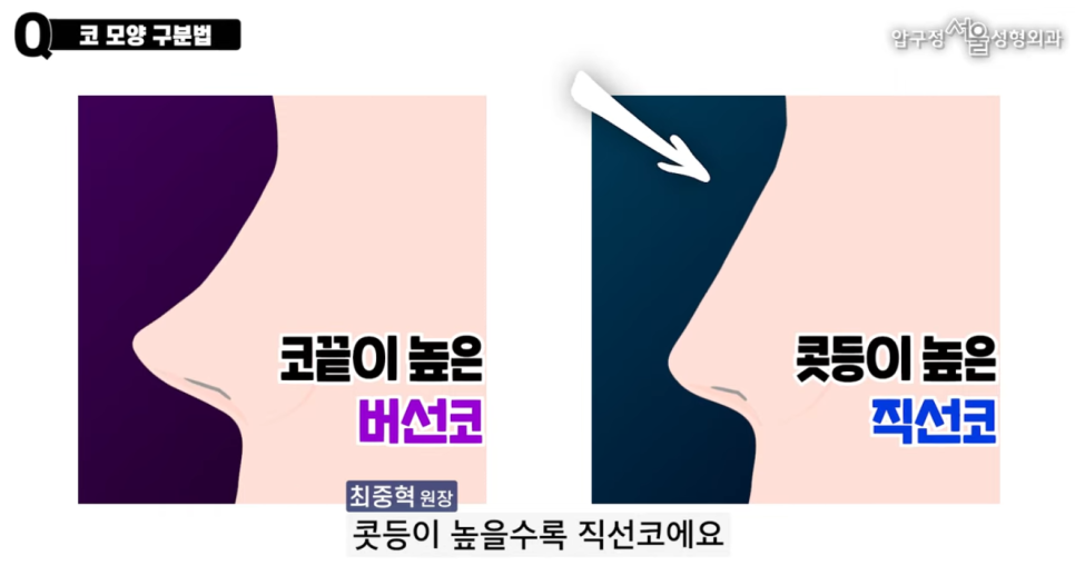 직선코 버선코 직반버선코 요즘 핫한 최신 코 트랜드 관련 이미지 5