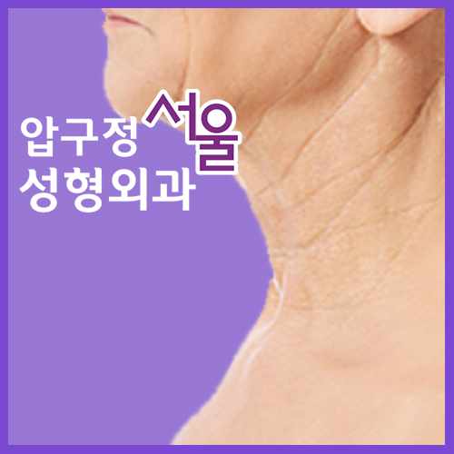 Neck Wrinkle Surgery: In This Weather, Are You Planning to Wear a Scarf? image 7