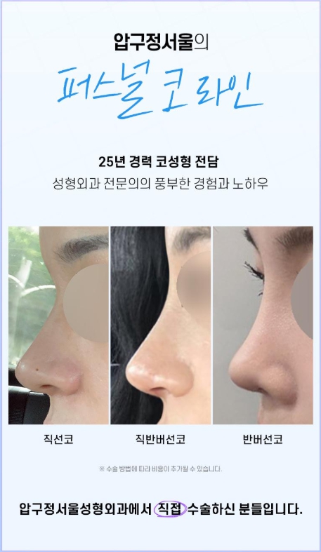 압구정서울성형외과 설윤 직선라인 자려한코성형 최중혁원장님 관련 이미지 3