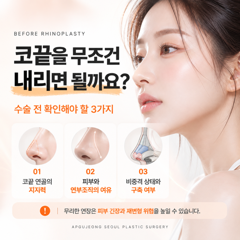들창코 성형 압구정서울성형외과 "정면에서 콧구멍이 보인다면?" 관련 이미지 6