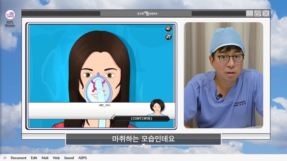 매부리코 코수술 게임 후기 및 비중격연골 매부리 코수술 방법 코수술 진행 과정 압구정서울성형외과 관련 이미지 2