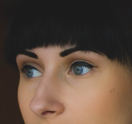 Apgujeong Plastic Surgery Review: Improved Hump Nose with a Straight Nose Line image 3