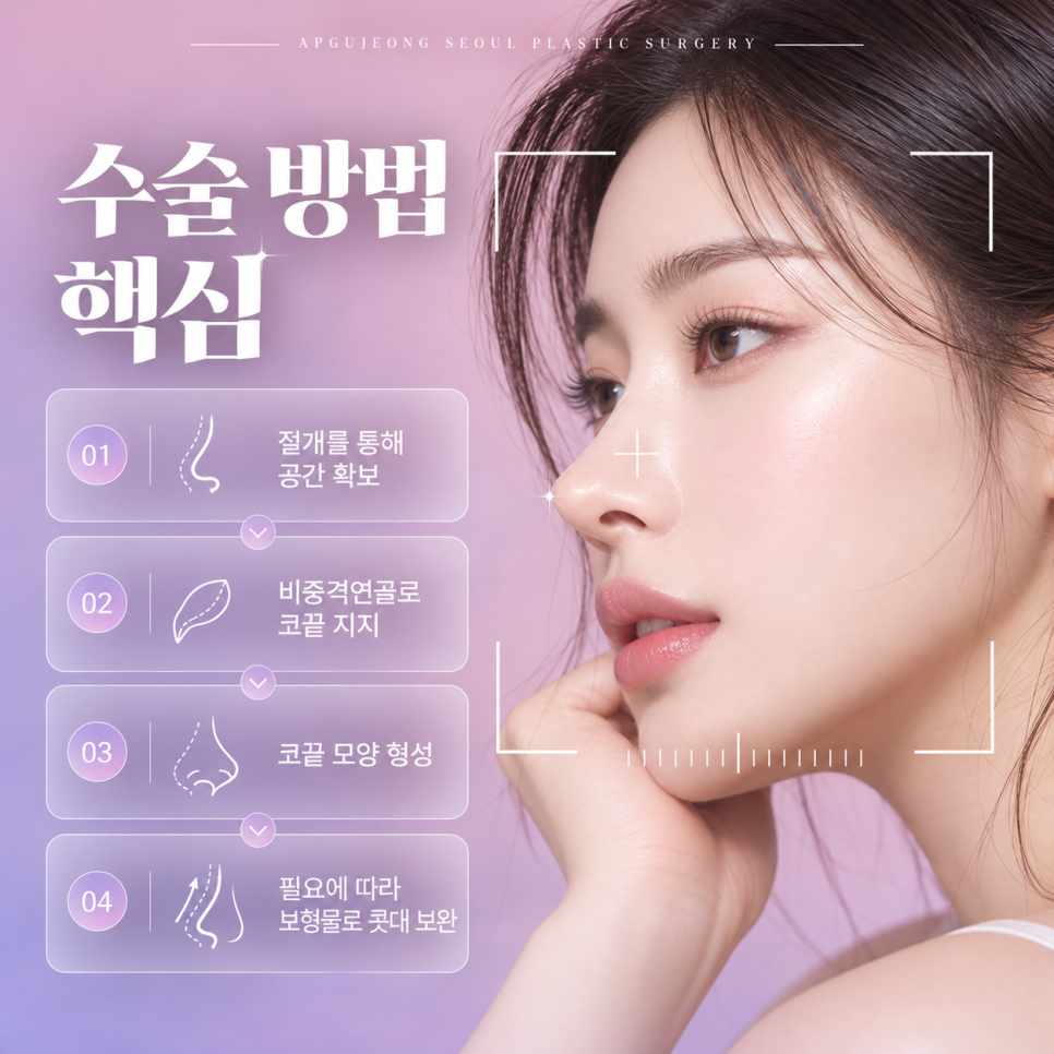 낮은코성형 압구정서울성형외과, 콧대보다 코끝이 중요한 이유 관련 이미지 4