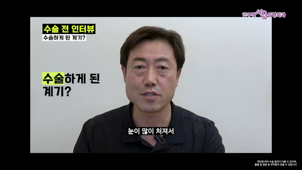남자 이마거상 1년 후 실제 후기와 수술 전 알아야 할 핵심 포인트 관련 이미지 2