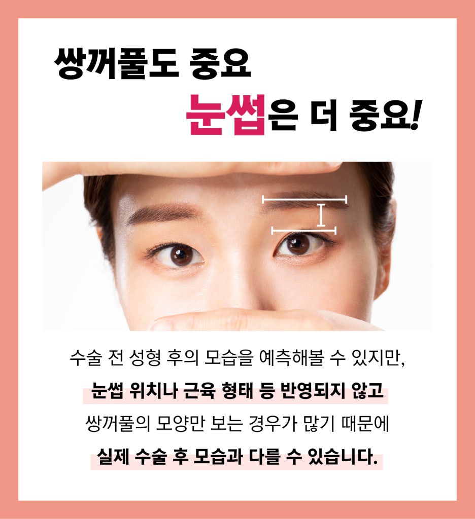 Asymmetrical Face at Apgujeong Seoul Plastic Surgery image 5