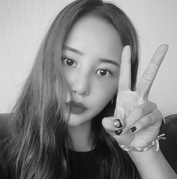 Customized Surgery by Nose Surgery Type, Fast Recovery, and a Good Place for Revision Rhinoplasty: Apgujeong Seoul Plastic Surgery image 6