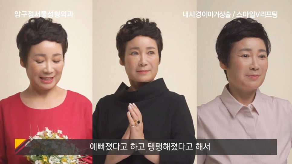 주름 동안 성형 후 딸이 정말 못 알아볼까요? 관련 이미지 3