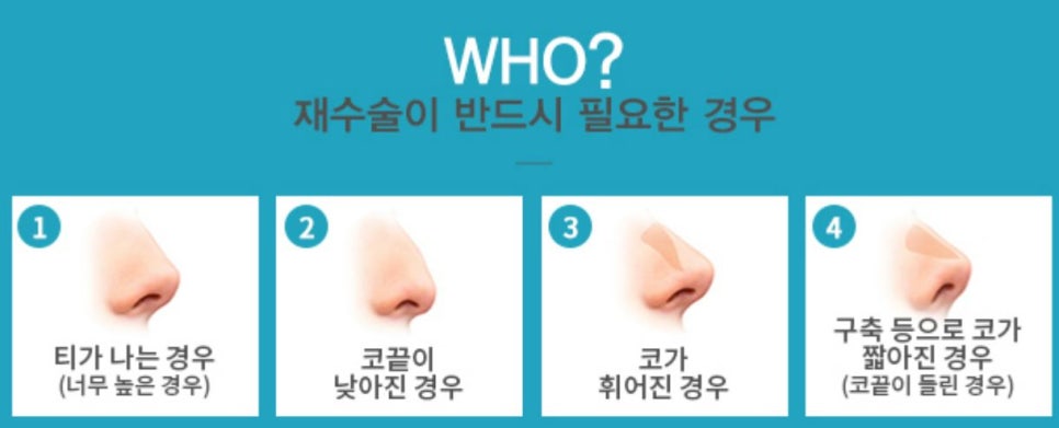 Apgujeong Seoul Plastic Surgery: Revision Rhinoplasty Methods by Type and Reviews image 3