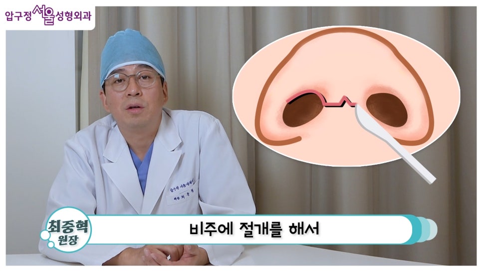 개방형 비개방형 코수술 차이점 장단점까지 한눈에 정리 관련 이미지 6