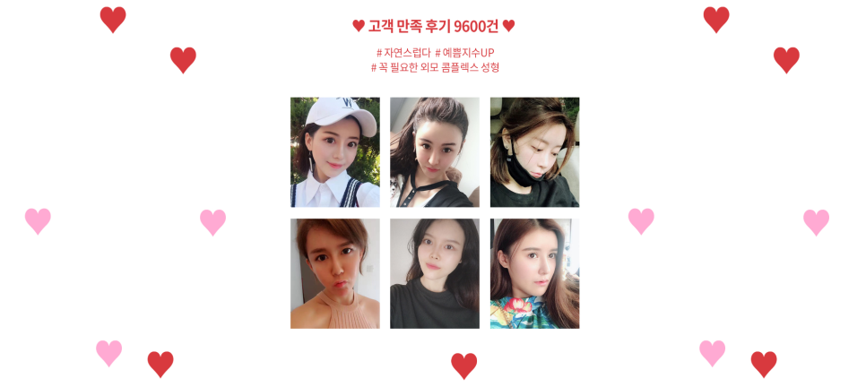 압구정서울성형외과 여름한정 <1+2 이벤트> 관련 이미지 3