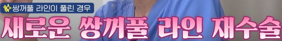 압구정 눈재수술 눈성형 눈수술의 모든 것, 압구정서울성형외과 관련 이미지 18