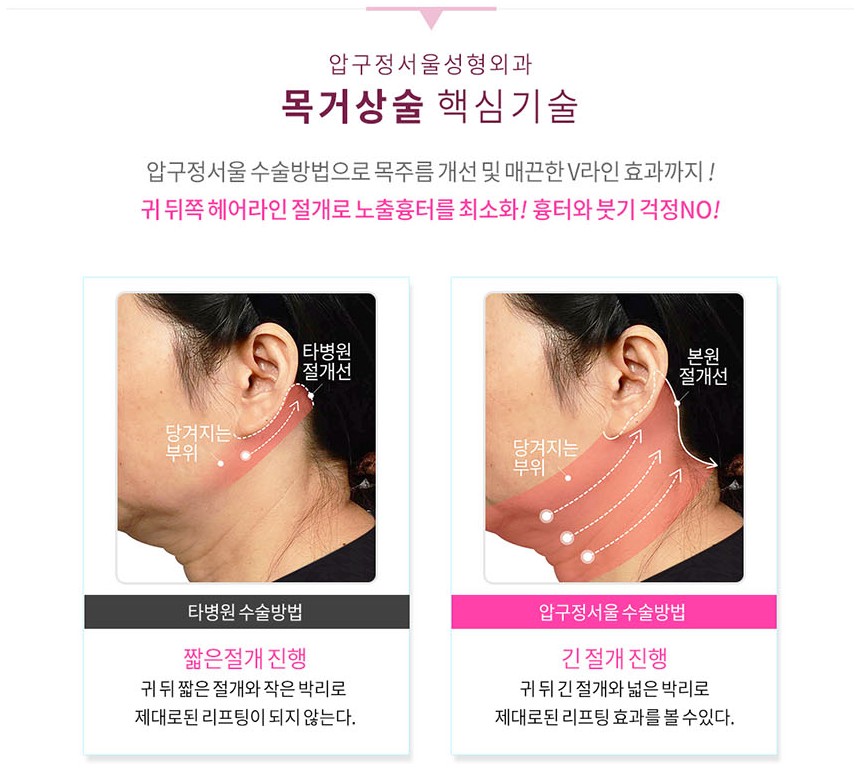 Neck Wrinkle Surgery: In This Weather, Are You Planning to Wear a Scarf? image 1