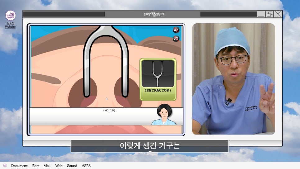 매부리코 코수술 게임 후기 및 비중격연골 매부리 코수술 방법 코수술 진행 과정 압구정서울성형외과 관련 이미지 5
