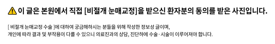 [Apgujeong Seoul Plastic Surgery] Non-incisional Eye Correction for Clearer, More Defined Eyes image 6
