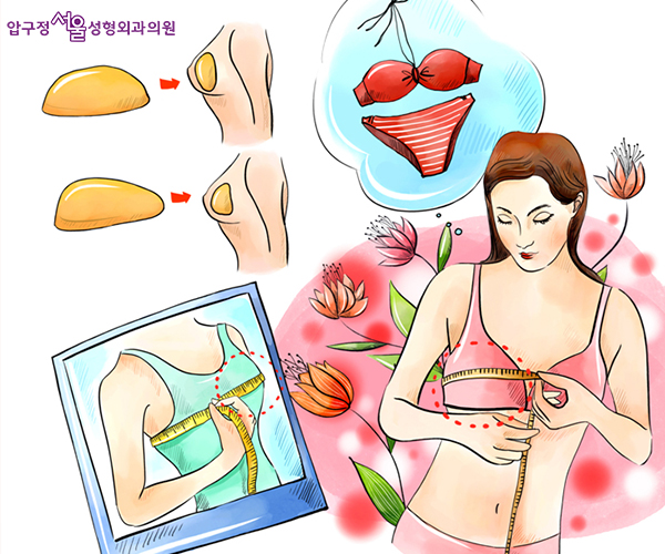 Post-Breast Surgery Care — Apgujeong Seoul Explains It Clearly image 1