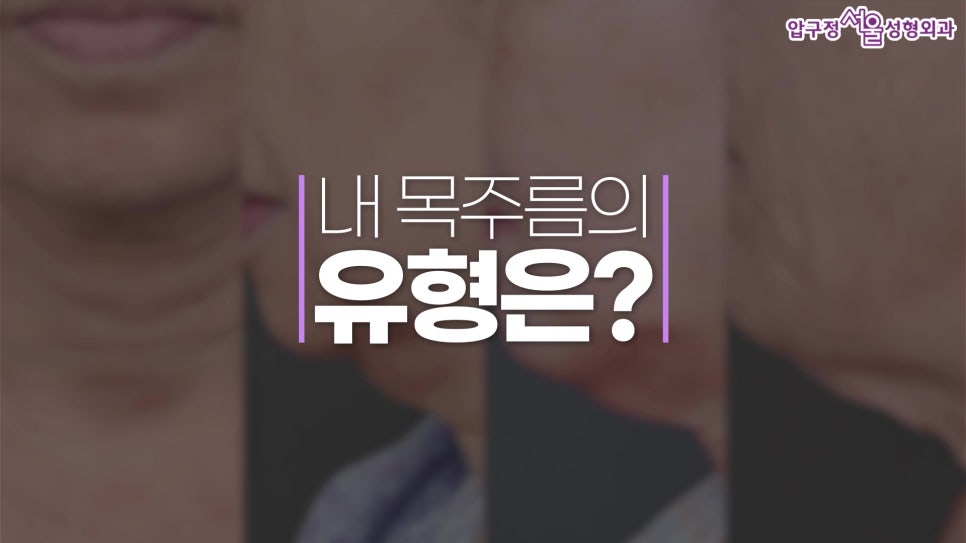 [목거상술 - 압구정 동안성형] 나의 목주름 유형은? 관련 이미지 1