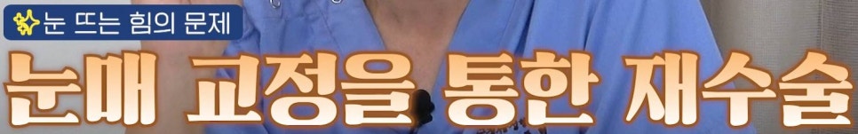 압구정 눈재수술 눈성형 눈수술의 모든 것, 압구정서울성형외과 관련 이미지 20