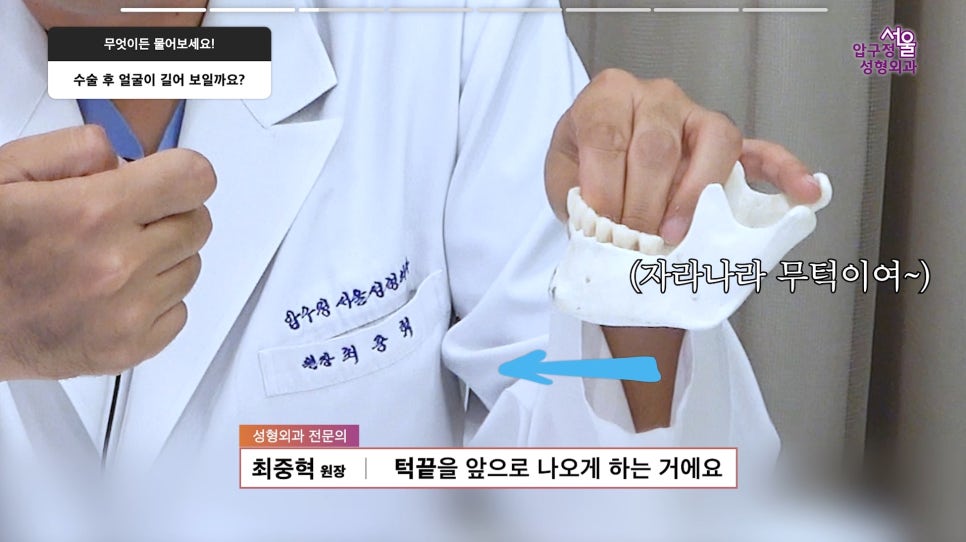 무턱보형물 무턱수술 무턱 부작용 주의사항 모든 정리 압구정서울성형외과 관련 이미지 9