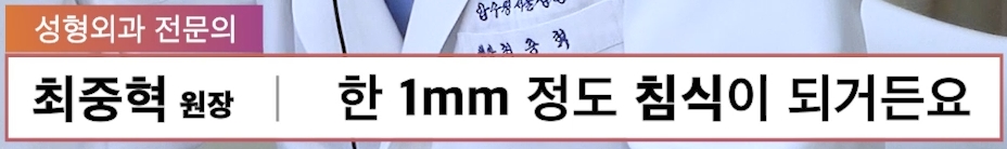 무턱보형물 무턱수술 무턱 부작용 주의사항 모든 정리 압구정서울성형외과 관련 이미지 6