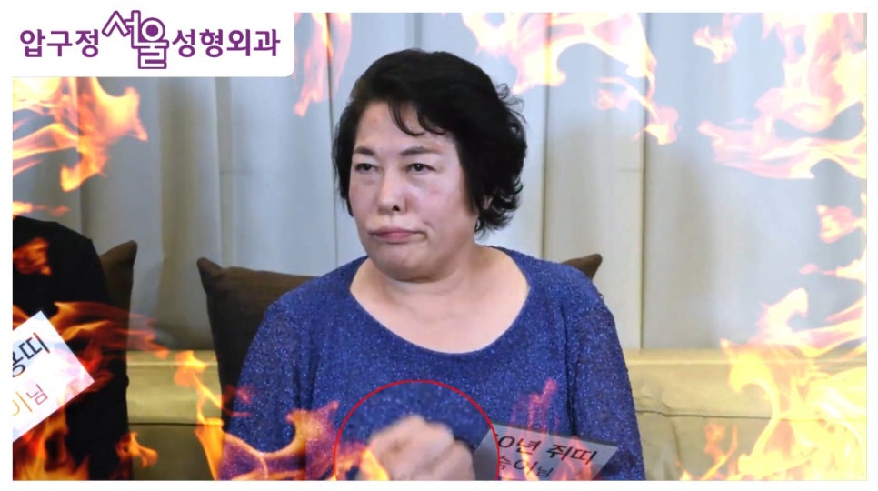 A Honest Talk on Wrinkle Surgery from Mothers, Part 2! image 2