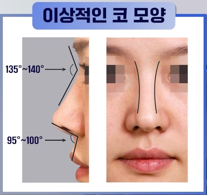 압구정서울성형외과 성형수술 상담 시 필수 준비물 관련 이미지 5