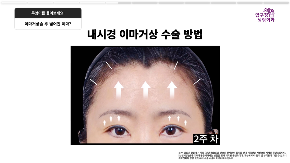 이마거상 유지기간 회복기간, 수술 전 알아야 할 핵심 Q&A 관련 이미지 9