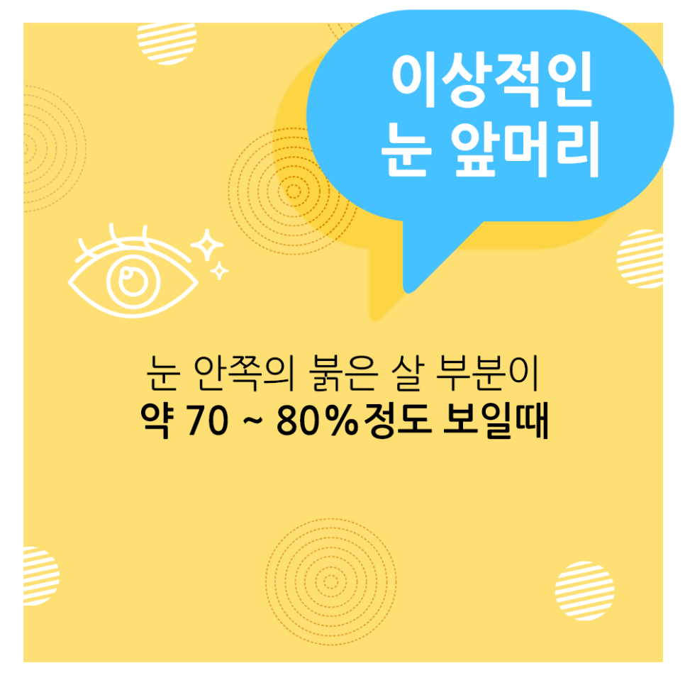 What Is the Ideal Eye Shape, According to Apgujeong Seoul Plastic Surgery? image 3