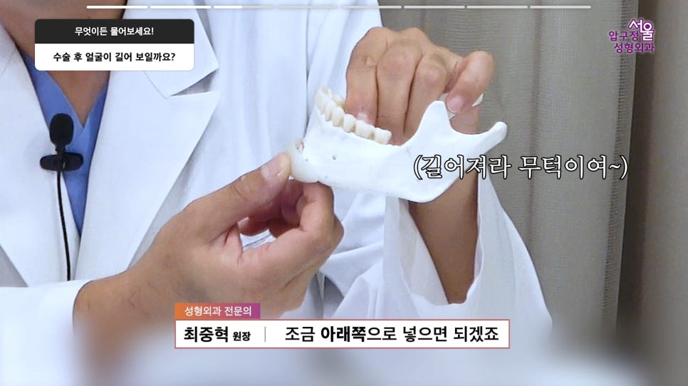 무턱보형물 무턱수술 무턱 부작용 주의사항 모든 정리 압구정서울성형외과 관련 이미지 10