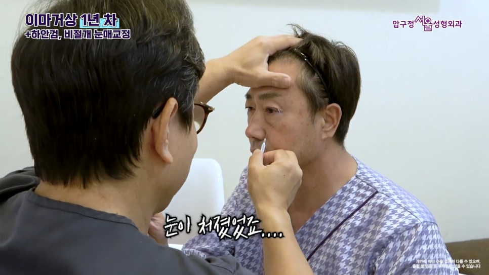 남자 이마거상 1년 후 실제 후기와 수술 전 알아야 할 핵심 포인트 관련 이미지 5