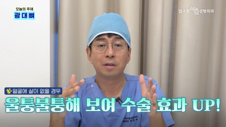 Types of Zygoma Reduction Surgery, Contour Surgery That Can Correct a Peanut-Shaped Face | Apgujeong Seoul Plastic Surgery image 16