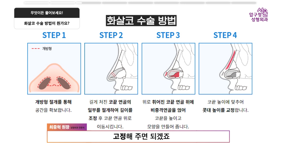 Arrow Nose Correction: The Truth About Self-Diagnosis and Nonsurgical Correction from Apgujeong Seoul Plastic Surgery image 4