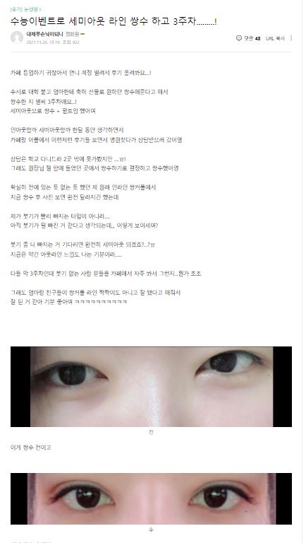Lovely Eyes Are No Longer Difficult! [Apgujeong Seoul Plastic Surgery] image 2