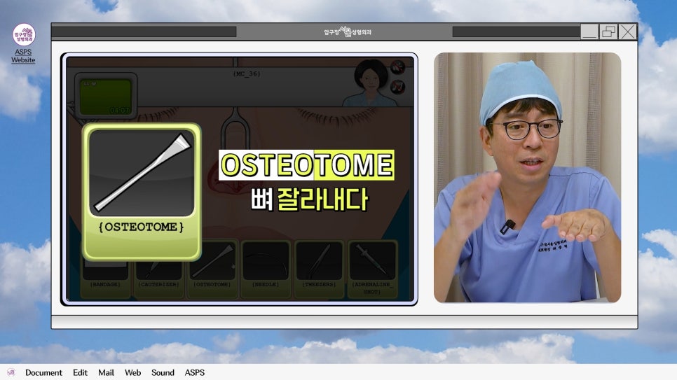 매부리코 코수술 게임 후기 및 비중격연골 매부리 코수술 방법 코수술 진행 과정 압구정서울성형외과 관련 이미지 12