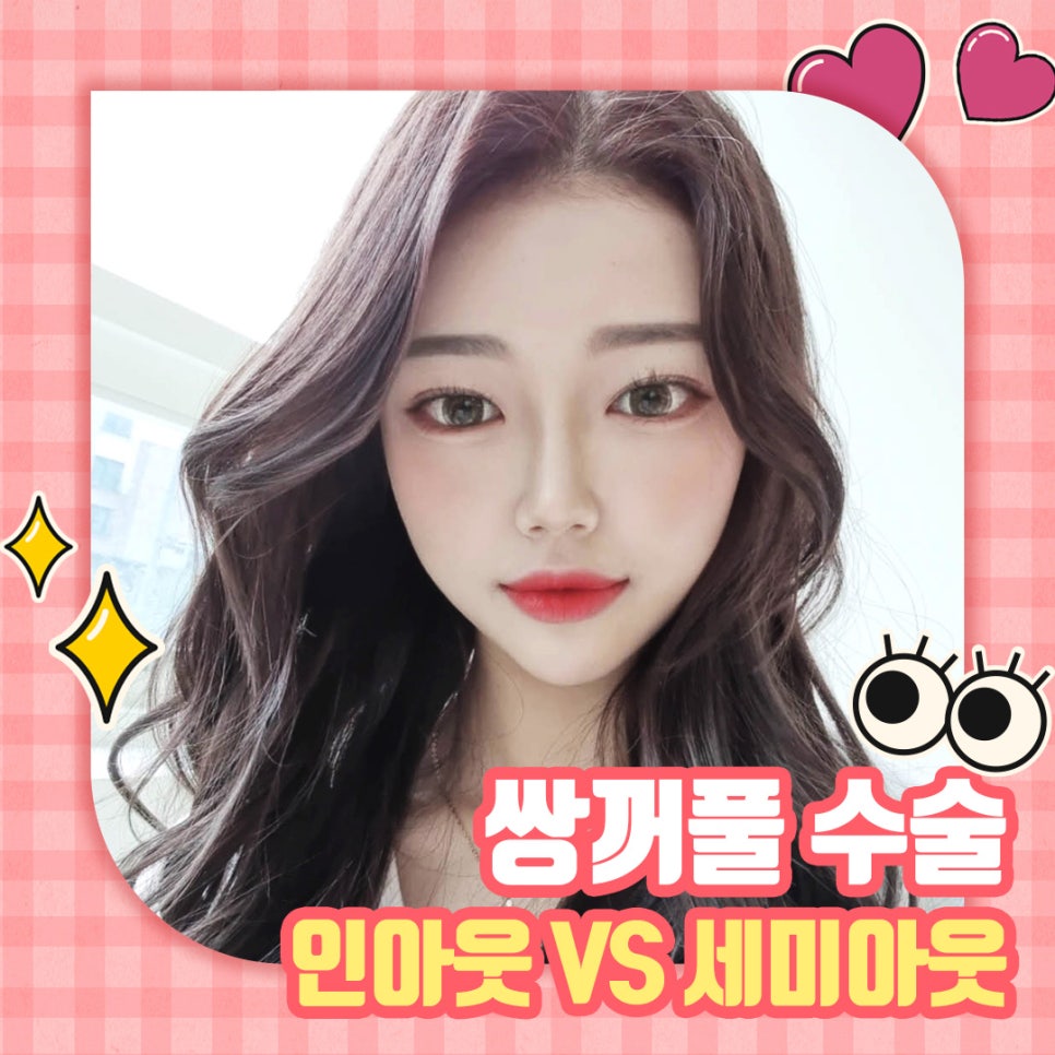 [Apgujeong Best Double Eyelid Clinic] What Is the Difference Between an In-Out and a Semi-Out Double Eyelid Line? image 1